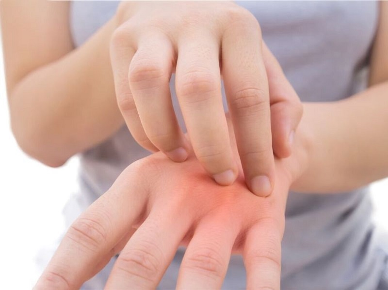 Da tay có thể bị khô, nứt nẻ hay kích ứng khi tiếp xúc quá nhiều với hoá chất làm nail