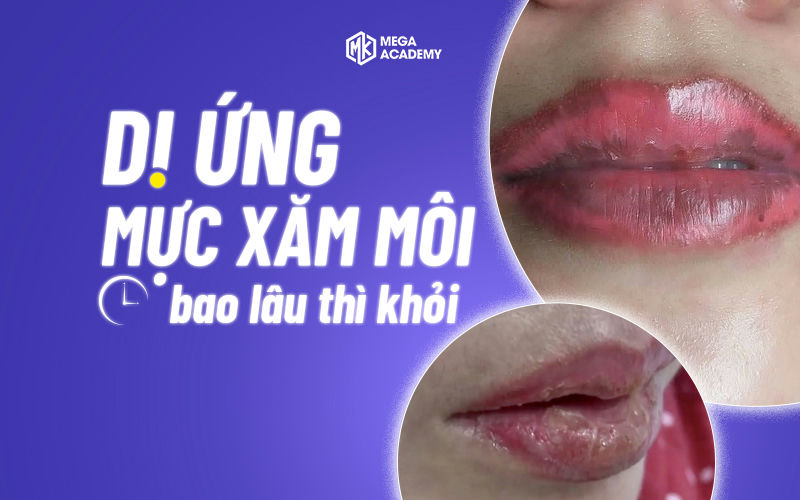 Dị ứng mực xăm môi bao lâu thì sẽ khỏi? Cách chữa ra sao?