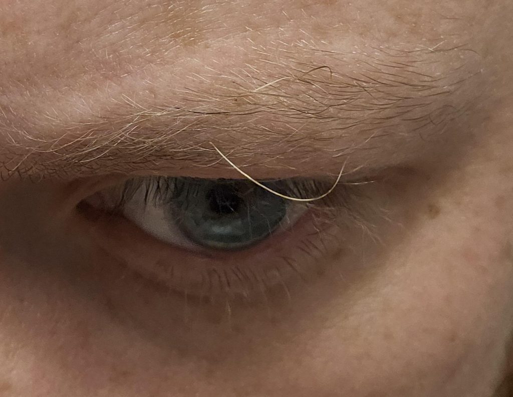 Có nên nhổ lông mày bạc không?