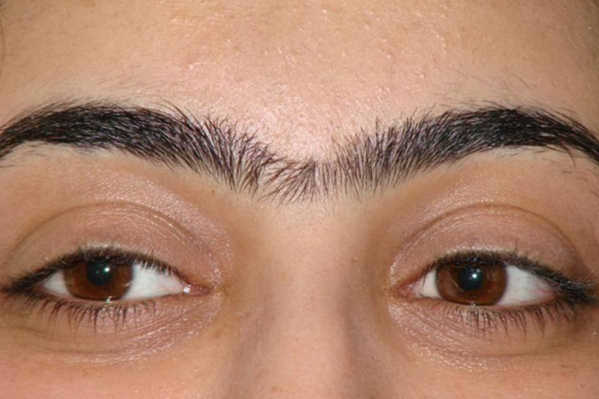 Lông mày giao nhau là như thế nào?