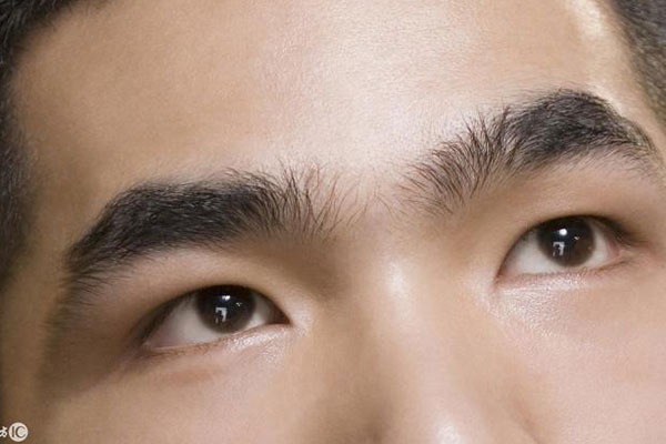 Lông mày giao nhau ở đàn ông