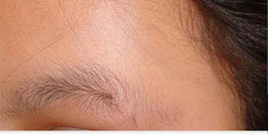 Đặc điểm của lông mày xoáy