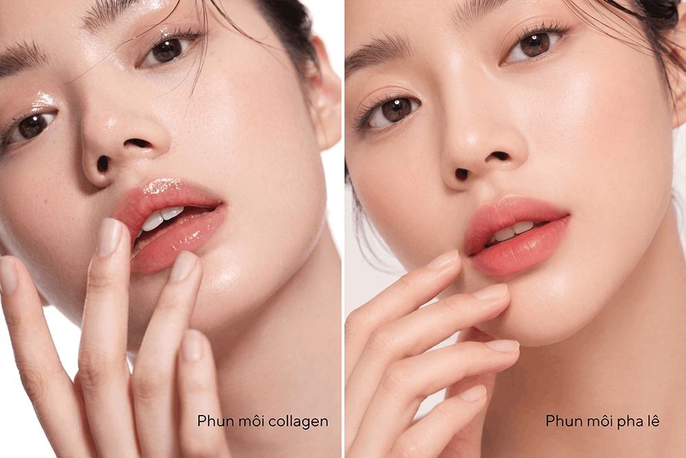 Phun môi pha lê và collagen có điểm tương đồng nhưng cũng có nhiều khác biệt khiến nhiều phụ nữ nhầm lẫn